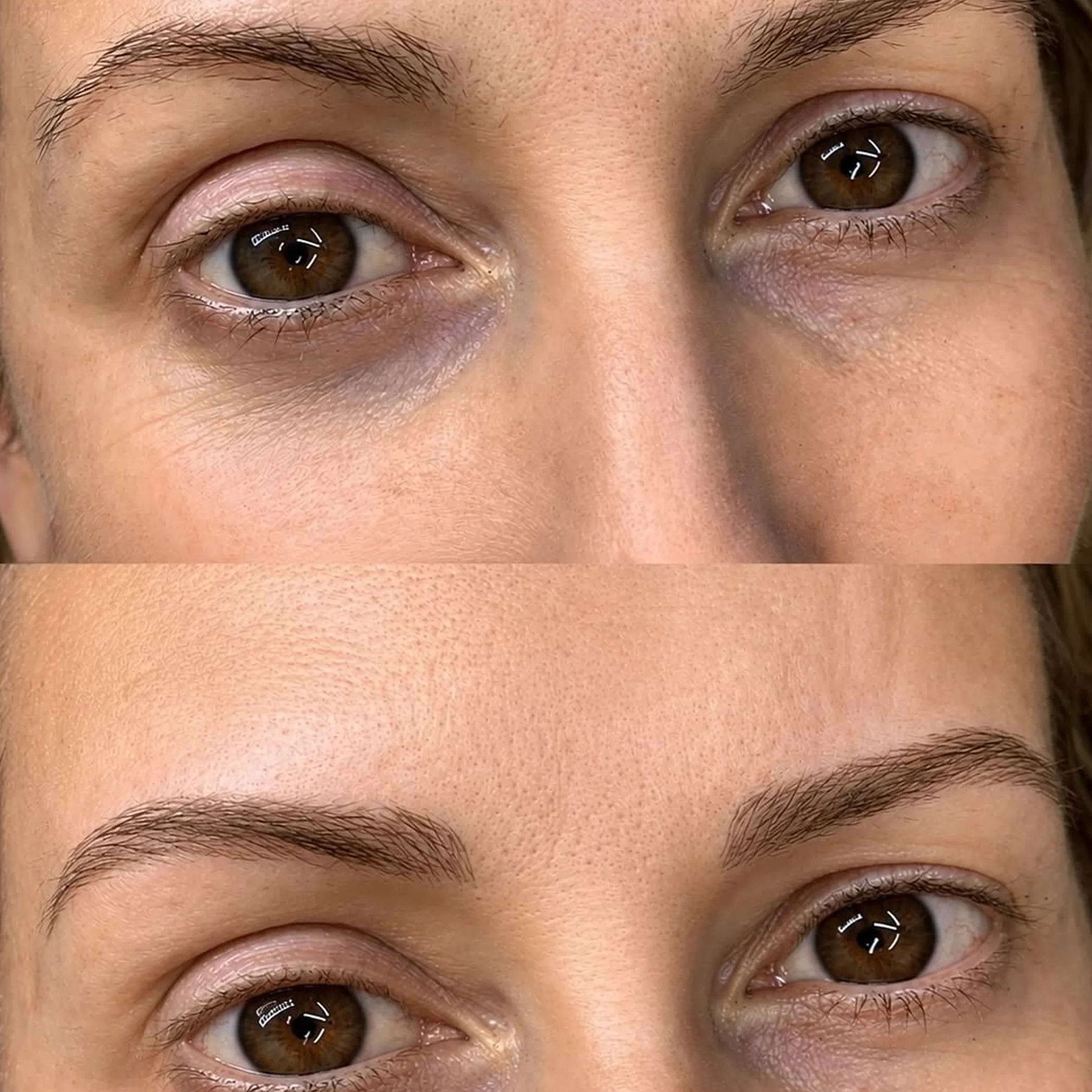 eyebrow cosmetic tattooing close-up